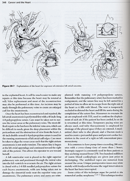 Cancer and the Heart