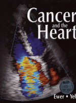 Cancer and the Heart