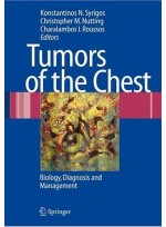 Tumors of the Chest : Biology, Diagnosis and Management