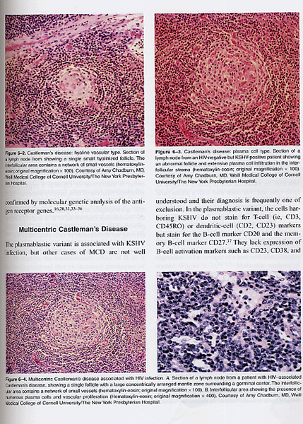 Viral and Immunological Malignancies