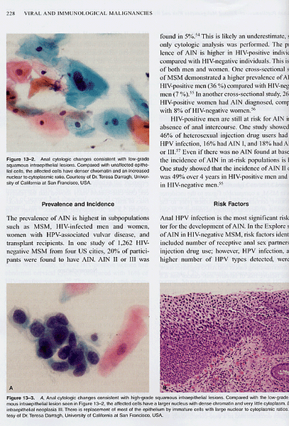 Viral and Immunological Malignancies