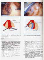 대장항문외과 요점과 맹점