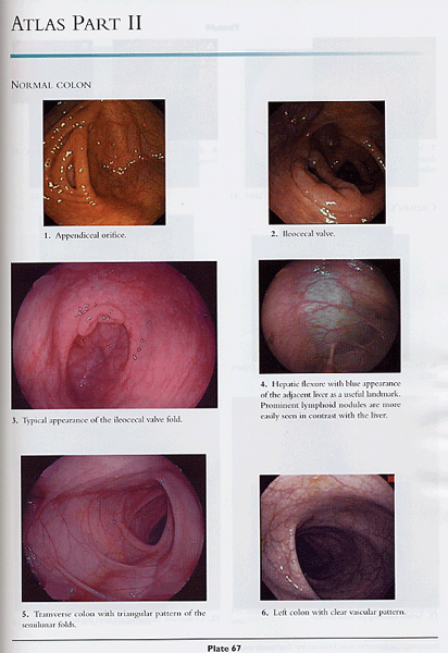 Pediatric Gastrointestinal Endoscopy: Textbook And Atlas