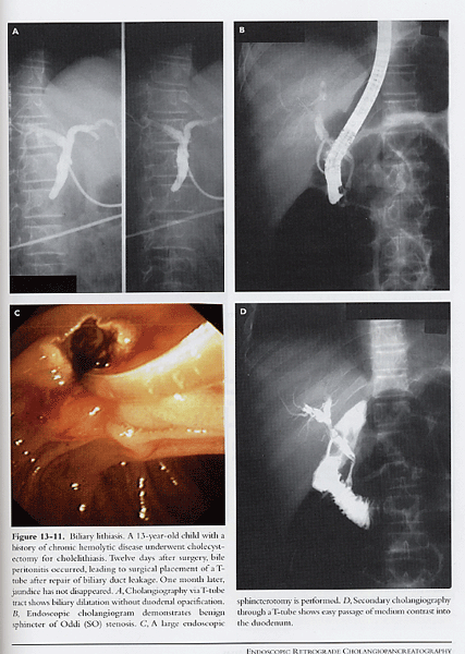 Pediatric Gastrointestinal Endoscopy: Textbook And Atlas