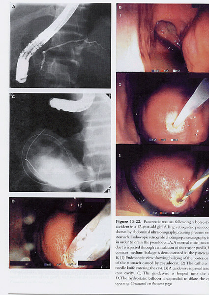 Pediatric Gastrointestinal Endoscopy: Textbook And Atlas