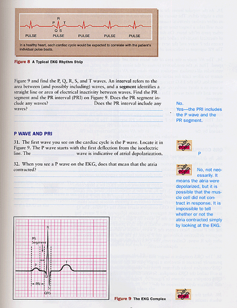 Basic Arrhythmias, 6/e