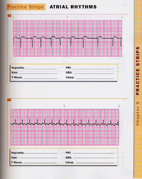 Basic Arrhythmias, 6/e