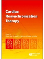 Cardiac Resynchronization Therapy