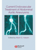 Current Endovascular Treatment of Abdominal Aortic Aneurysms