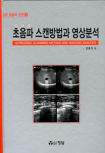 초음파 스캔방법과 영상분석