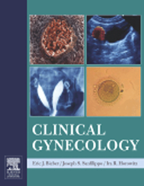 Clinical Gynecology(With CD-ROM)