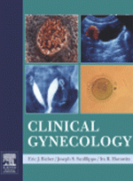 Clinical Gynecology(With CD-ROM)