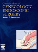 Complications of Gynecologic Endoscopic Surgery