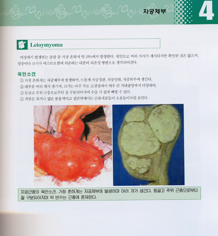 산부인과 진단병리