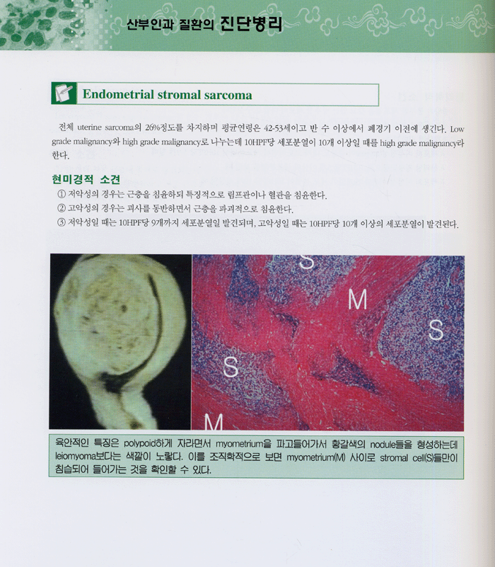 산부인과 진단병리