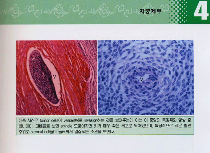 산부인과 진단병리