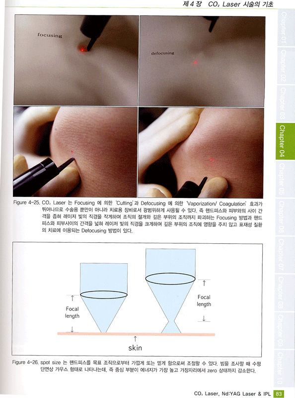 CO2 Laser, ND:Yag Laser & IPL