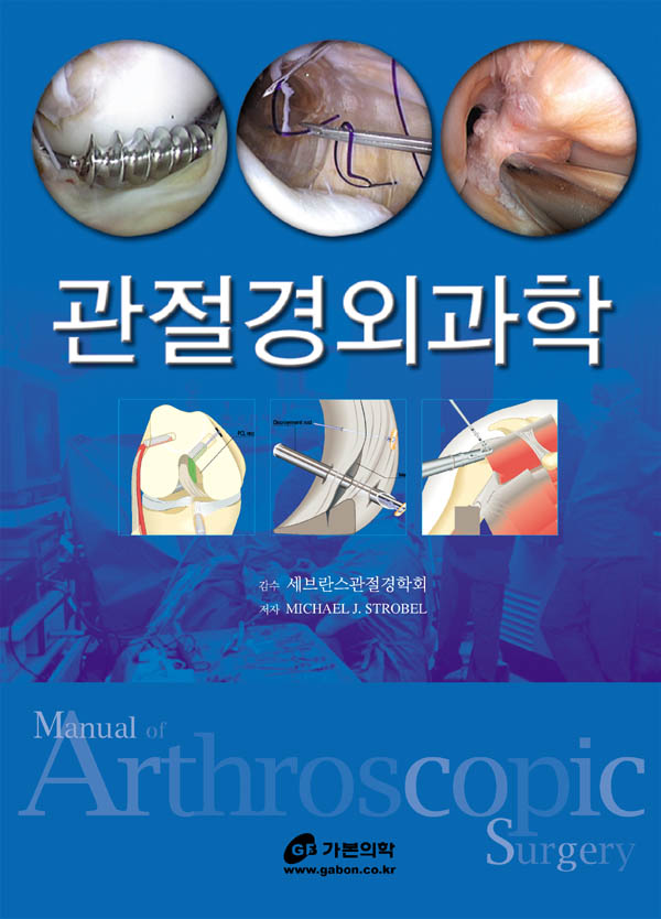 관절경외과학 : manual of arthroscopic surgery