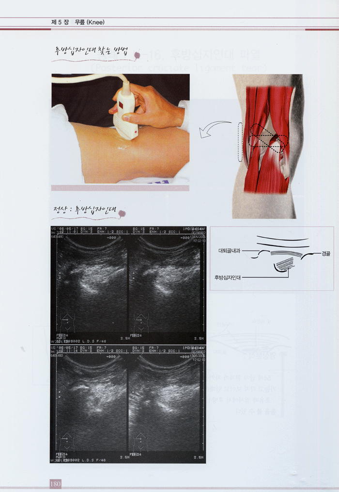 근골격계 초음파 진단과 치료 - Musculoskeletal ultrasonogram