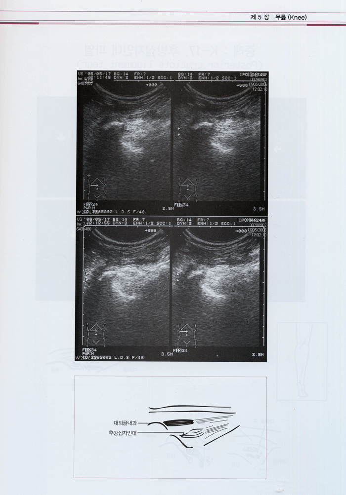 근골격계 초음파 진단과 치료 - Musculoskeletal ultrasonogram