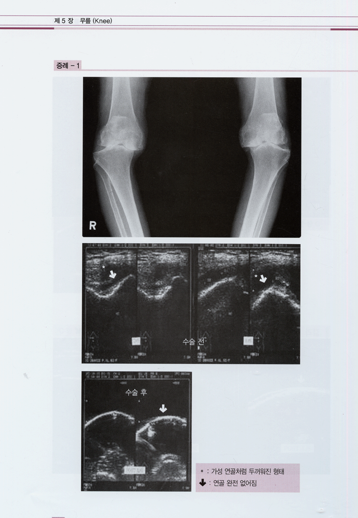 근골격계 초음파 진단과 치료 - Musculoskeletal ultrasonogram