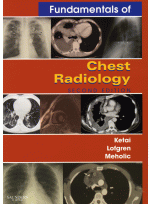 Fundamentals of Chest Radiology 2th