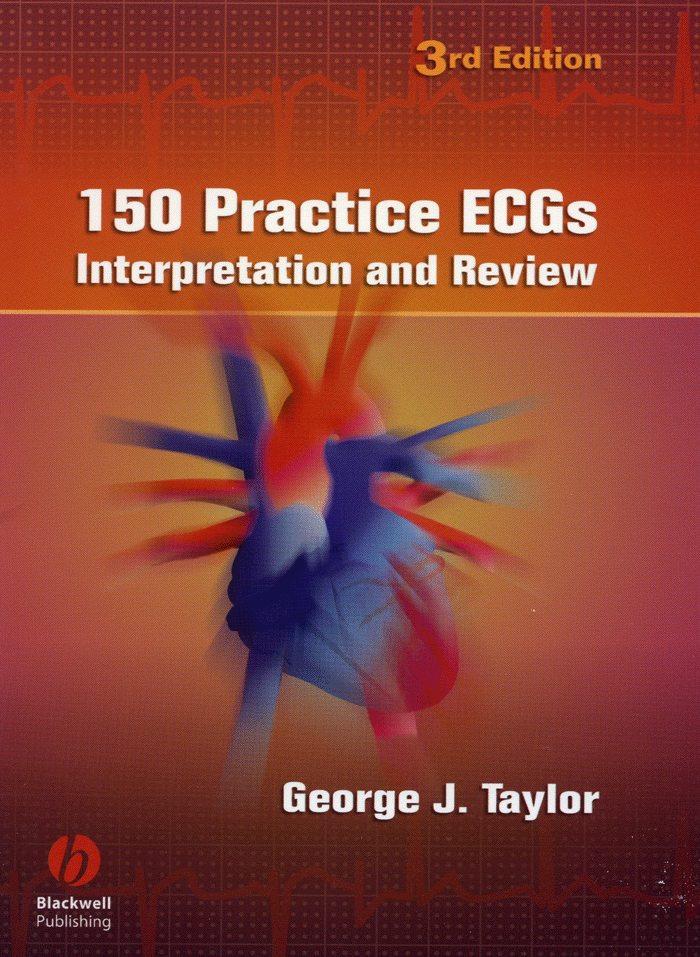 150 Practice ECGs Interpretation and Review 3th
