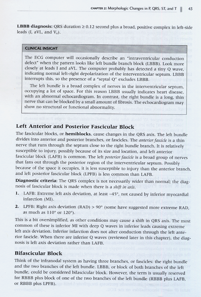 150 Practice ECGs Interpretation and Review 3th