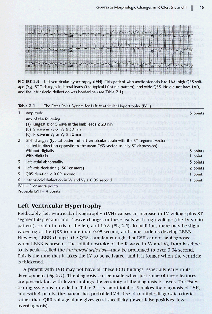 150 Practice ECGs Interpretation and Review 3th