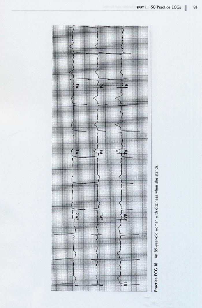 150 Practice ECGs Interpretation and Review 3th