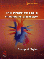 150 Practice ECGs Interpretation and Review 3th