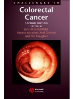 Challenges in Colorectal Cancer, 2th edition