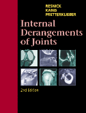 Internal Derangements of Joints, 2nd Edition