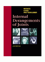 Internal Derangements of Joints, 2nd Edition