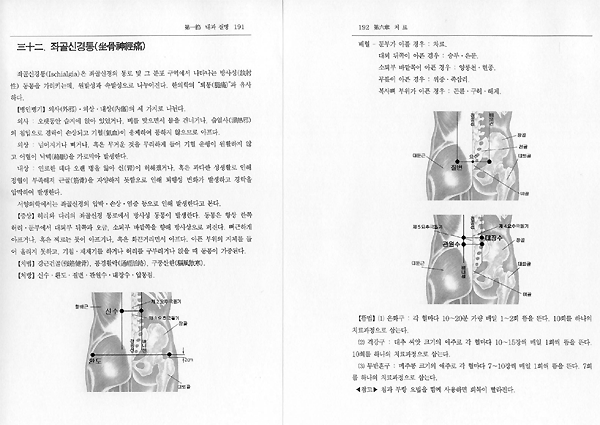 만병을 치료하는 쑥뜸요법