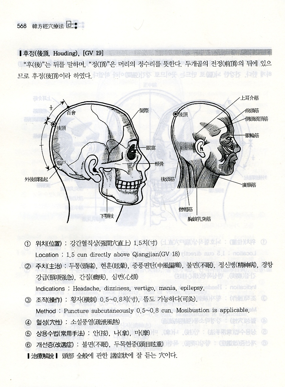 한방경혈요법