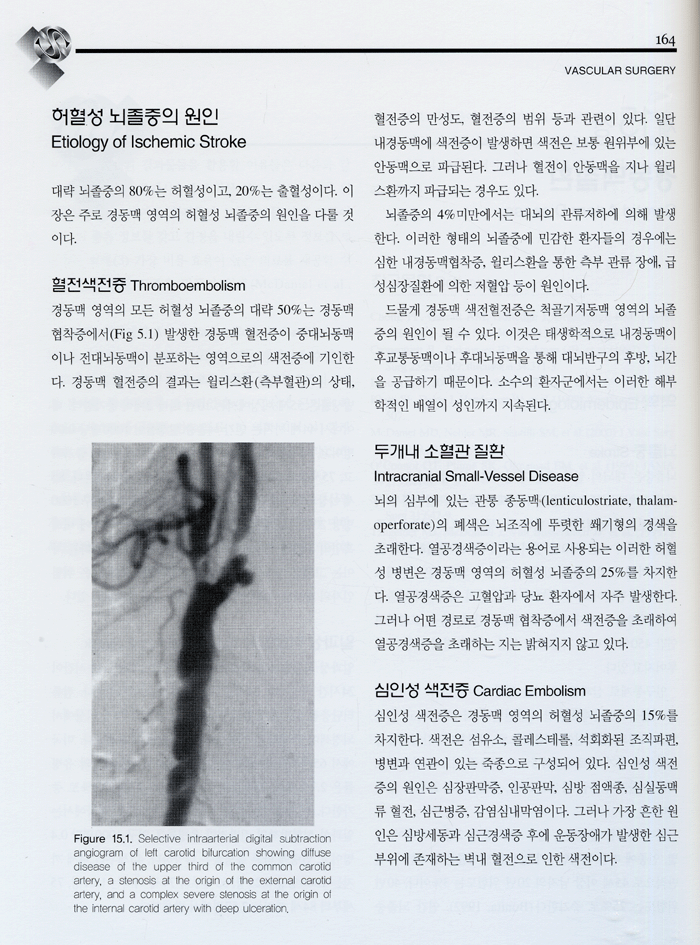 혈관외과