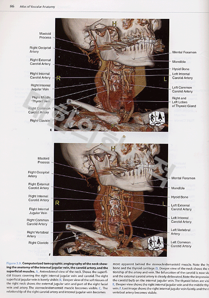 Atlas of Vascular Anatomy ,2/e