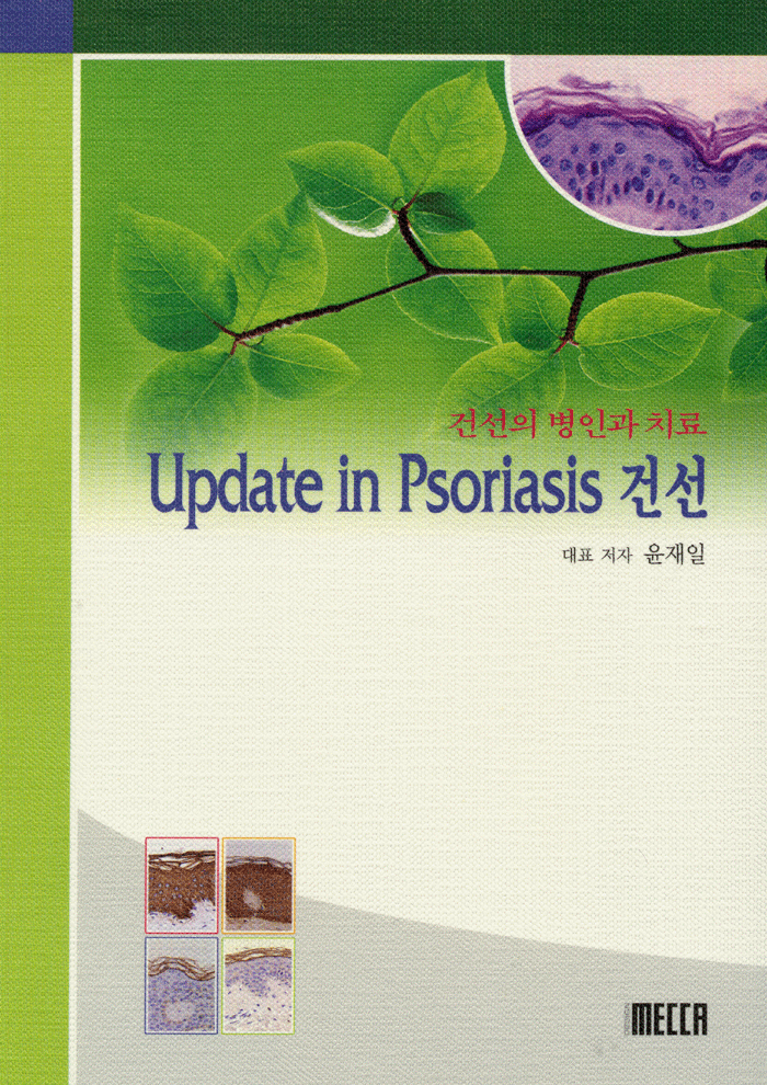 건선의 병인과 치료 UPDATE IN PSORIASIS 건선