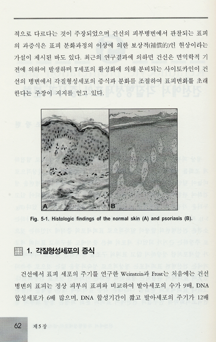 건선의 병인과 치료 UPDATE IN PSORIASIS 건선