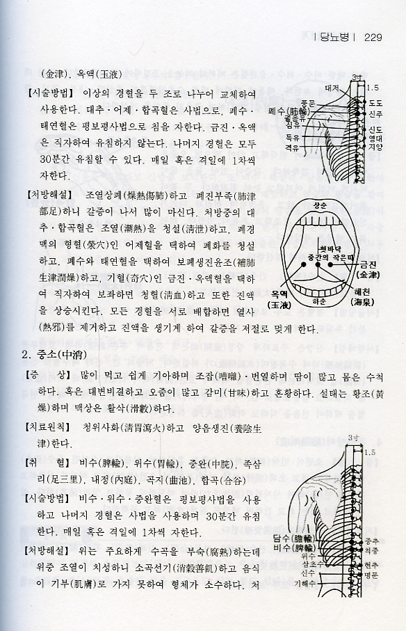 중의변증 침구치료처방