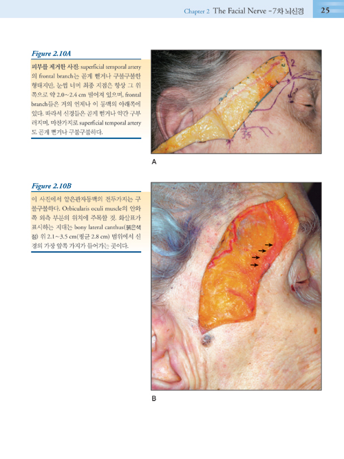 안와주위 미용성형해부(Surgical Anatomy Around the Orbit the System of Zone) [DVD 무료증정]