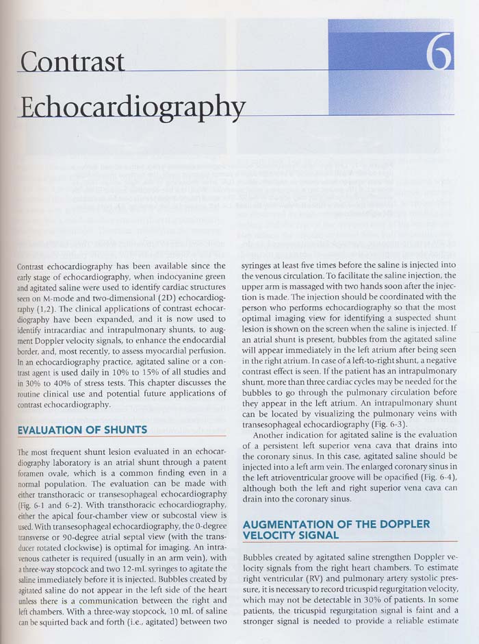 The Echo Manual 3/e