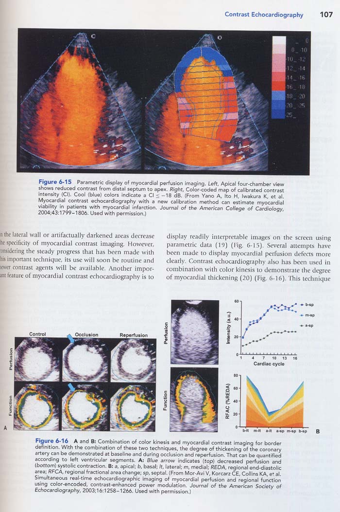 The Echo Manual 3/e