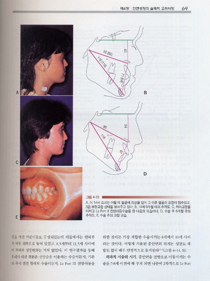 소아구강악안면외과