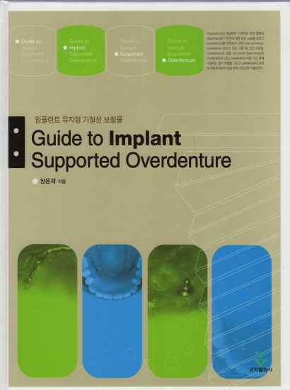 임플란트 유지형 가철성 보철물(Guide to Implant Supported Overdenture)