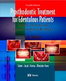 Prosthodontic Treatment for Edentulous Patients (4e) - Complete Dentures and Implant-Supported Prostheses