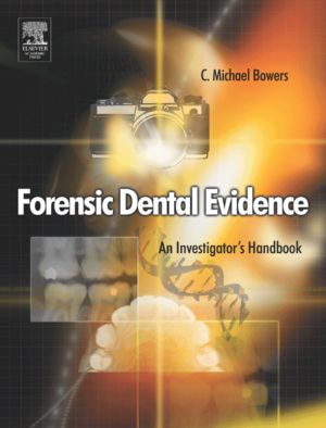 Forensic Dental Evidence