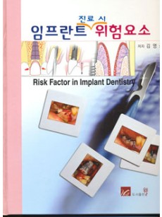 임프란트진료시위험요소 (Risk Factor in Implant Dentistry)