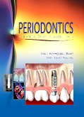 Periodontics - Medicine Surgery and Implants
